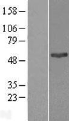 Western Blot: PNPLA3 Overexpression Lysate (Adult Normal) [NBL1-14555] Left-Empty vector transfected control cell lysate (HEK293 cell lysate); Right -Over-expression Lysate for PNPLA3.
