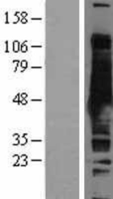 Western Blot: S Adenosylhomocysteine Hydrolase Overexpression Lysate (Adult Normal) [NBL1-07402] Left-Empty vector transfected control cell lysate (HEK293 cell lysate); Right -Over-expression Lysate for S Adenosylhomocysteine Hydrolase.