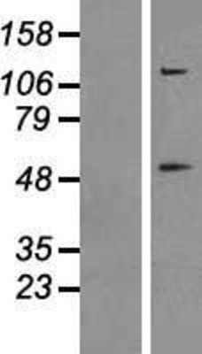 Western Blot: Caspase 8 Overexpression Lysate (Adult Normal) [NBP2-10964] Left-Empty vector transfected control cell lysate (HEK293 cell lysate); Right -Over-expression Lysate for Caspase 8.