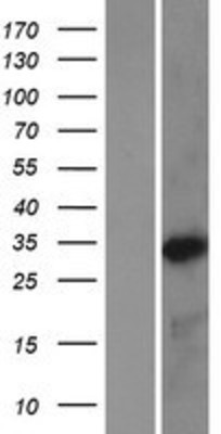 Western Blot: NKX3-2 Overexpression Lysate (Adult Normal) [NBP2-10960] Left-Empty vector transfected control cell lysate (HEK293 cell lysate); Right -Over-expression Lysate for NKX3-2.