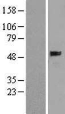 Western Blot: Soluble Liver/Pancreas Antigen Overexpression Lysate (Adult Normal) [NBL1-15816] Left-Empty vector transfected control cell lysate (HEK293 cell lysate); Right -Over-expression Lysate for Soluble Liver/Pancreas Antigen.
