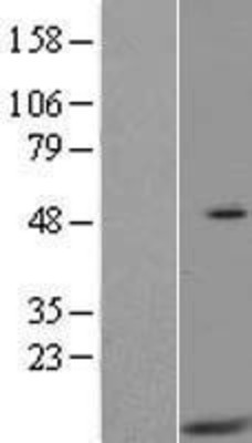 Western Blot: HIGD2A Overexpression Lysate (Adult Normal) [NBL1-11544] Left-Empty vector transfected control cell lysate (HEK293 cell lysate); Right -Over-expression Lysate for HIGD2A.