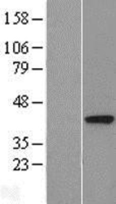 Western Blot: DALRD3 Overexpression Lysate (Adult Normal) [NBL1-09714] Left-Empty vector transfected control cell lysate (HEK293 cell lysate); Right -Over-expression Lysate for DALRD3.
