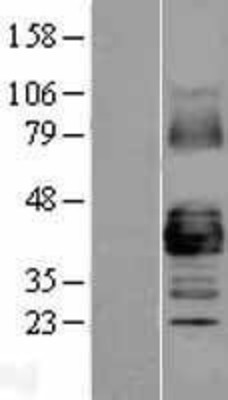 Western Blot: Connexin 43/GJA1 Overexpression Lysate (Adult Normal) [NBL1-11086] Left-Empty vector transfected control cell lysate (HEK293 cell lysate); Right -Over-expression Lysate for Connexin 43/GJA1.
