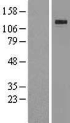 Western Blot: Klotho Overexpression Lysate (Adult Normal) [NBL1-12307] Left-Empty vector transfected control cell lysate (HEK293 cell lysate); Right -Over-expression Lysate for Klotho.