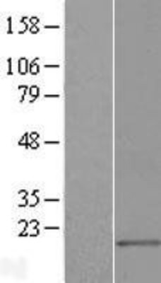Western Blot: MED21 Overexpression Lysate (Adult Normal) [NBL1-12986] Left-Empty vector transfected control cell lysate (HEK293 cell lysate); Right -Over-expression Lysate for MED21.
