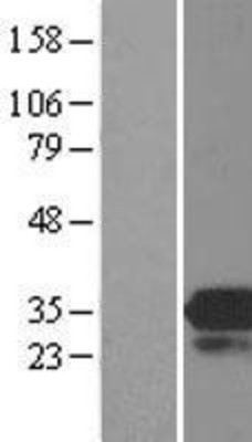 Western Blot: MOBKL3 Overexpression Lysate (Adult Normal) [NBL1-13173] Left-Empty vector transfected control cell lysate (HEK293 cell lysate); Right -Over-expression Lysate for MOBKL3.