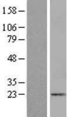 Western Blot: ICAP1 Overexpression Lysate (Adult Normal) [NBL1-12071] Left-Empty vector transfected control cell lysate (HEK293 cell lysate); Right -Over-expression Lysate for ICAP1.