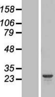 Western Blot: HYI Overexpression Lysate (Adult Normal) [NBL1-11796] Left-Empty vector transfected control cell lysate (HEK293 cell lysate); Right -Over-expression Lysate for HYI.