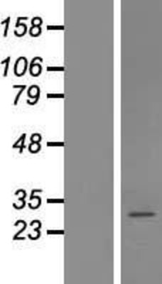 Western Blot: Coatomer protein complex, subunit zeta 2 Overexpression Lysate (Adult Normal) [NBL1-09388] Left-Empty vector transfected control cell lysate (HEK293 cell lysate); Right -Over-expression Lysate for Coatomer protein complex, subunit zeta 2.
