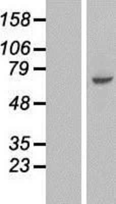 Western Blot: FAM198B Overexpression Lysate (Adult Normal) [NBL1-08464] Left-Empty vector transfected control cell lysate (HEK293 cell lysate); Right -Over-expression Lysate for FAM198B.