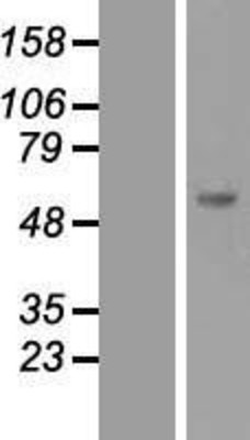 Western Blot: SOCS5 Overexpression Lysate (Adult Normal) [NBL1-16330] Left-Empty vector transfected control cell lysate (HEK293 cell lysate); Right -Over-expression Lysate for SOCS5.