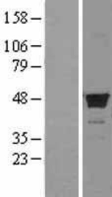 Western Blot: FDFT1 Overexpression Lysate (Adult Normal) [NBL1-10668] Left-Empty vector transfected control cell lysate (HEK293 cell lysate); Right -Over-expression Lysate for FDFT1.