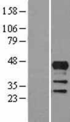 Western Blot: Lhx4 Overexpression Lysate (Adult Normal) [NBL1-12516] Left-Empty vector transfected control cell lysate (HEK293 cell lysate); Right -Over-expression Lysate for Lhx4.