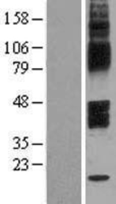 Western Blot: Galanin Receptor GalR2 Overexpression Lysate (Adult Normal) [NBL1-10962] Left-Empty vector transfected control cell lysate (HEK293 cell lysate); Right -Over-expression Lysate for Galanin Receptor GalR2.