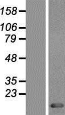 Western Blot: Thioredoxin Overexpression Lysate (Adult Normal) [NBP2-10886] Left-Empty vector transfected control cell lysate (HEK293 cell lysate); Right -Over-expression Lysate for Thioredoxin.