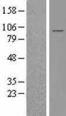 Western Blot: IFT88 Overexpression Lysate (Adult Normal) [NBL1-11863] Left-Empty vector transfected control cell lysate (HEK293 cell lysate); Right -Over-expression Lysate for IFT88.