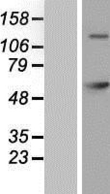 Western Blot: GAD65 Overexpression Lysate (Adult Normal) [NBP2-10700] Left-Empty vector transfected control cell lysate (HEK293 cell lysate); Right -Over-expression Lysate for GAD65.