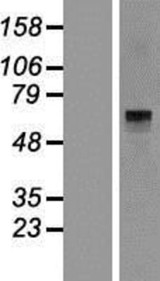 Western Blot: Histidase Overexpression Lysate (Adult Normal) [NBP2-10781] Left-Empty vector transfected control cell lysate (HEK293 cell lysate); Right -Over-expression Lysate for Histidase.