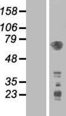 Western Blot: PDPK1 Overexpression Lysate (Adult Normal) [NBL1-14259] Left-Empty vector transfected control cell lysate (HEK293 cell lysate); Right -Over-expression Lysate for PDPK1.