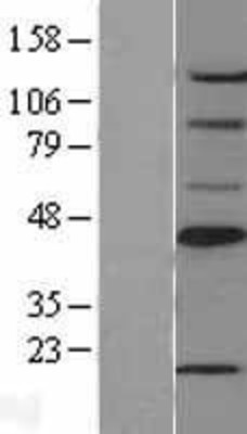 Western Blot: SCD Overexpression Lysate (Adult Normal) [NBL1-15724] Left-Empty vector transfected control cell lysate (HEK293 cell lysate); Right -Over-expression Lysate for SCD.