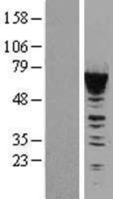 Western Blot: CACNB1 Overexpression Lysate (Adult Normal) [NBL1-08628] Left-Empty vector transfected control cell lysate (HEK293 cell lysate); Right -Over-expression Lysate for CACNB1.
