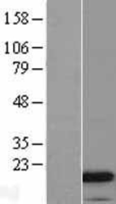 Western Blot: Cathelicidin Overexpression Lysate (Adult Normal) [NBL1-08670] Left-Empty vector transfected control cell lysate (HEK293 cell lysate); Right -Over-expression Lysate for Cathelicidin.