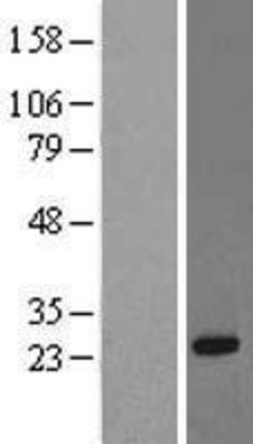 Western Blot: RRAS Overexpression Lysate (Adult Normal) [NBL1-15588] Left-Empty vector transfected control cell lysate (HEK293 cell lysate); Right -Over-expression Lysate for RRAS.