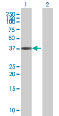 Lane 1: ETV7 transfected lysate (39 KDa) Lane 2: Non-transfected lysate.