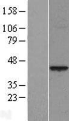 Western Blot: PRR11 Overexpression Lysate (Adult Normal) [NBL1-14831] Left-Empty vector transfected control cell lysate (HEK293 cell lysate); Right -Over-expression Lysate for PRR11.
