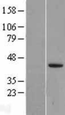 Western Blot: LEFTY2 Overexpression Lysate (Adult Normal) [NBL1-12485] Left-Empty vector transfected control cell lysate (HEK293 cell lysate); Right -Over-expression Lysate for LEFTY2.