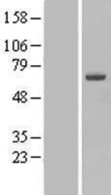 Western Blot: CSGALNACT2 Overexpression Lysate (Adult Normal) [NBL1-09521] Left-Empty vector transfected control cell lysate (HEK293 cell lysate); Right -Over-expression Lysate for CSGALNACT2.