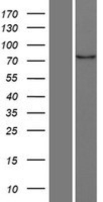 Western Blot: MARK4 Overexpression Lysate (Adult Normal) [NBL1-12900] Left-Empty vector transfected control cell lysate (HEK293 cell lysate); Right -Over-expression Lysate for MARK4.