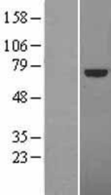 Western Blot: TCF4 Overexpression Lysate (Adult Normal) [NBL1-16775] Left-Empty vector transfected control cell lysate (HEK293 cell lysate); Right -Over-expression Lysate for TCF4.