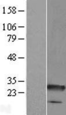 Western Blot: C8orf33 Overexpression Lysate (Adult Normal) [NBL1-08566] Left-Empty vector transfected control cell lysate (HEK293 cell lysate); Right -Over-expression Lysate for C8orf33.