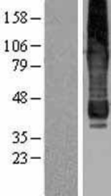Western Blot: AGPAT6 Overexpression Lysate (Adult Normal) [NBP2-04439] Left-Empty vector transfected control cell lysate (HEK293 cell lysate); Right -Over-expression Lysate for AGPAT6.