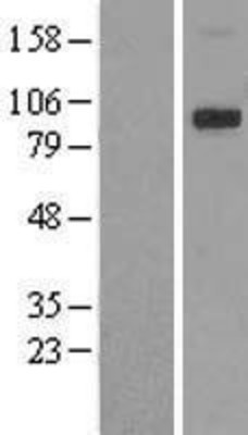 Western Blot: TRPV4 Overexpression Lysate (Adult Normal) [NBL1-17344] Left-Empty vector transfected control cell lysate (HEK293 cell lysate); Right -Over-expression Lysate for TRPV4.