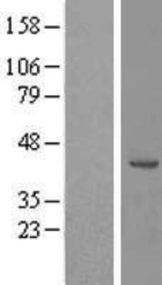 Western Blot: RRS1 Overexpression Lysate (Adult Normal) [NBL1-15594] Left-Empty vector transfected control cell lysate (HEK293 cell lysate); Right -Over-expression Lysate for RRS1.