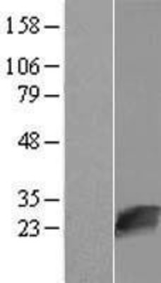 Western Blot: NUDT16L1 Overexpression Lysate (Adult Normal) [NBL1-13857] Left-Empty vector transfected control cell lysate (HEK293 cell lysate); Right -Over-expression Lysate for NUDT16L1.
