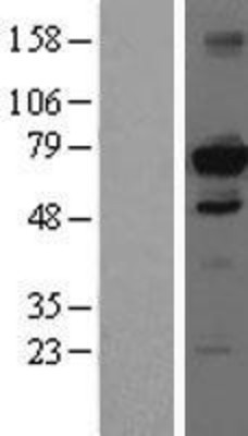 Western Blot: HDAC10 Overexpression Lysate (Adult Normal) [NBL1-11478] Left-Empty vector transfected control cell lysate (HEK293 cell lysate); Right -Over-expression Lysate for HDAC10.