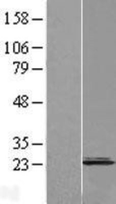 Western Blot: CNPY2 Overexpression Lysate (Adult Normal) [NBL1-09323] Left-Empty vector transfected control cell lysate (HEK293 cell lysate); Right -Over-expression Lysate for CNPY2.