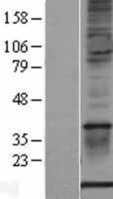 Western Blot: S100A1 Overexpression Lysate (Adult Normal) [NBL1-15647] Left-Empty vector transfected control cell lysate (HEK293 cell lysate); Right -Over-expression Lysate for S100A1.