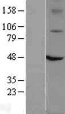 Western Blot: TRPV1 Overexpression Lysate (Adult Normal) [NBL1-17340] Left-Empty vector transfected control cell lysate (HEK293 cell lysate); Right -Over-expression Lysate for TRPV1.