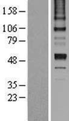 Western Blot: Antithrombin III Overexpression Lysate (Adult Normal) [NBL1-15852] Left-Empty vector transfected control cell lysate (HEK293 cell lysate); Right -Over-expression Lysate for Antithrombin III.