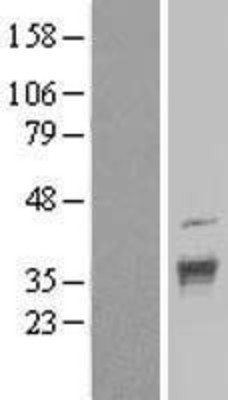 Western Blot: DNAJC17 Overexpression Lysate (Adult Normal) [NBL1-09948] Left-Empty vector transfected control cell lysate (HEK293 cell lysate); Right -Over-expression Lysate for DNAJC17.