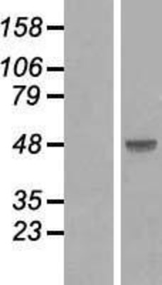 Western Blot: SMAD3 Overexpression Lysate (Adult Normal) [NBL1-16222] Left-Empty vector transfected control cell lysate (HEK293 cell lysate); Right -Over-expression Lysate for SMAD3.