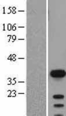 Western Blot: SOX2 Overexpression Lysate (Adult Normal) [NBL1-16348] Left-Empty vector transfected control cell lysate (HEK293 cell lysate); Right -Over-expression Lysate for SOX2.
