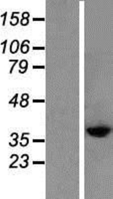Western Blot: CysLT2 Overexpression Lysate (Adult Normal) [NBP2-06656] Left-Empty vector transfected control cell lysate (HEK293 cell lysate); Right -Over-expression Lysate for CysLT2.