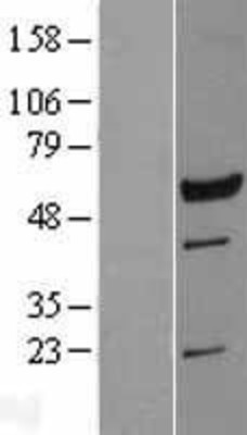 Western Blot: LRRC6 Overexpression Lysate (Adult Normal) [NBL1-12702] Left-Empty vector transfected control cell lysate (HEK293 cell lysate); Right -Over-expression Lysate for LRRC6.