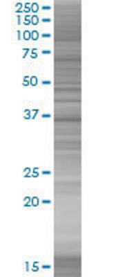 ETV7 transfected lysate.